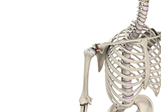 Acromioclavicular (AC) Joint Osteoarthritis