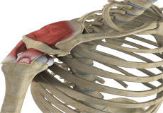 Partial Rotator Cuff Tear